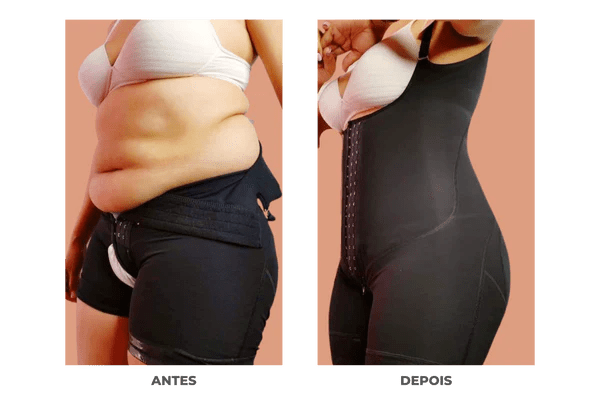 Cinta Modeladora Antes e Depois