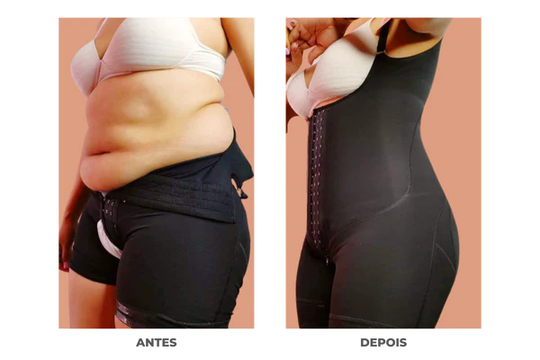 Cinta Modeladora Antes e Depois